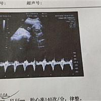 大家帮忙看一下，是男孩是女孩