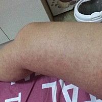 今天刚满37周，检查一下说宝宝有点脐绕颈，怀疑是不是这段时间晚上睡眠不好还老是翻身引起的，最近两腿...