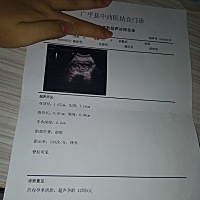 能看出男宝 女宝吗 好奇😃