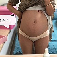 第一次发帖  纪念下32周🤓