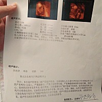 今天做了三维，挺顺利的，宝宝很配合，我妈妈说是女宝宝，给宝宝买的小床小衣服都是女式的，都是粉粉的哈哈