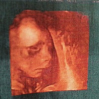 有经验的宝妈看看是男宝宝还是女宝宝？？，今天做完三维回来一直在看宝宝，听说现在什么样以后生出来就...