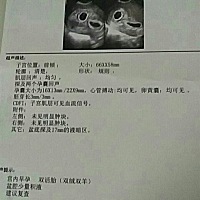 心情有点小复杂，老公回来的时候感觉自己在做梦，抽了自己几个耳光，真响😂😂😂