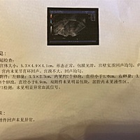 大家帮忙看下，今天去医院监测排卵的结果。本人8.2号来的月经，4天多！每个月的月经推迟两天左右，最长...