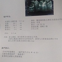 宝妈们看一下我的单子问题大吗，有一样的宝妈吗