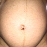 有经验的宝妈看看这个肚型是男宝还是女宝