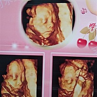 四维结果出来了，宝宝发育一切正常，有点小激动！