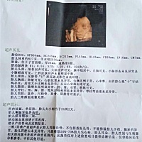 今天下午做的四维谁能看的出是男是女😂😂😂😂