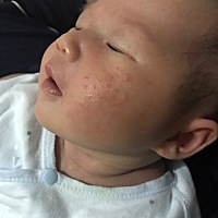 宝宝出生第十八天，昨天开始脸上长出这种小痘痘，红红的今天更多了，宝妈们知道怎么回事吗？该怎么办呢