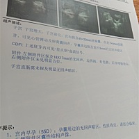 怀孕55天了，一切正常