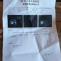 我按末次月经来算是九周大夫说是八周，帮我看下我这个正常吗