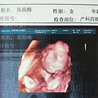 大家帮忙看看是女宝还是男宝啊