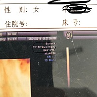 教各位宝妈怎么通过三维彩超看男女哦！！！我朋友都是这样看的，挺准的。如下图我圈出来的那一块high 后...