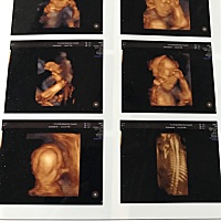 好奇宝宝是男是女，有会看的吗