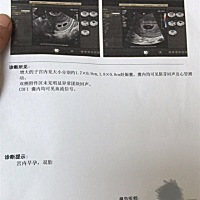 谢谢老天的恩赐，虽然很难受，总是吃了又呕，可是我还是会坚持吃下去，宝妈们接双胎。还有，需要注意些...