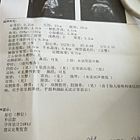 男孩女孩