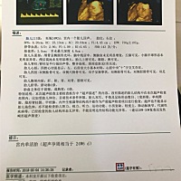 4维的时候就看出来是个小圆脸，果不其然啊，哈哈哈哈哈