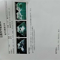 亲们，能帮我看看男孩女孩吗？听说孕囊能判断呢？谢谢😜