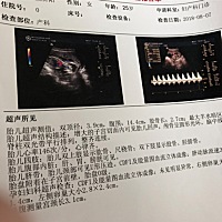 大家看一下，男孩女孩，纯属娱乐