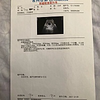 辛苦了这么多个月、宝宝终于出生了、八斤九两的男宝宝、顺产、可是这苦逼的月子是真的累啊！还好我...