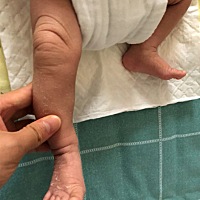 怎么感觉宝宝腿不直啊，看起来像O型腿，正常吗？是不是长长就直了啊