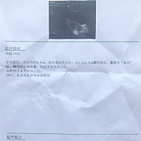 相隔10天的B超单对比一下，有没有大神帮忙看下偏男还是偏女…今天抽了血要验的，可是跑了好几个快递都不...