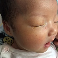 孩子出去第三天眼睛就流黄色眼屎，黄眼泪，眼睛也不红看着没啥问题，才二十天打算满月了带她看看去，问...