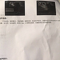 因为是怀孕第一次检查，才45天大夫只让我查血我说我想做个b超试试，大夫说现在做也没什么用怕浪费钱但是...