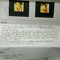 四维通过了…猜下男女