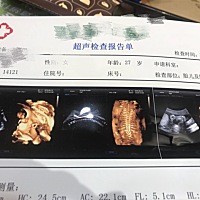 大家帮忙看看男孩女孩，谢谢🙏