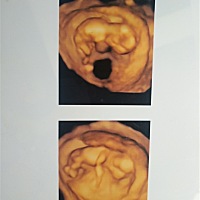 看看是男是女 第13周零1天 第21周零4天 第31周零3天