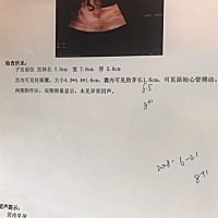 有没有哪位大神能帮我看出来是男孩女孩啊 目前八周 第一胎男孩女孩都喜欢 是真的太好奇了😂 拜托大家...