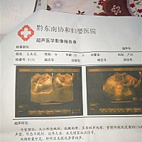 姐妹们给我看看这是什么意思。