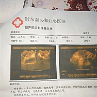 姐妹们给我看看这是什么意思呢