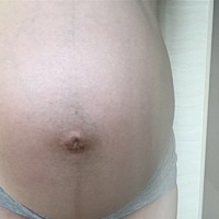 这肚型是儿子哟，宝宝出生9天了，20180809