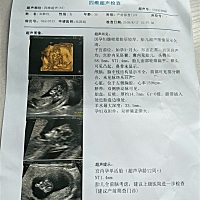 请有经验的医生宝妈们，帮我看看，这孩子是不是不能要呀，医生说大脑不好，现在三个月多几天了