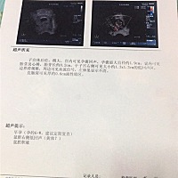 怀孕6周B超能看性别吗？