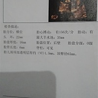 是男孩还是女孩啊，有没有宝妈会看的