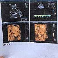 能看出来是男宝还是女宝宝吗😂😂😂