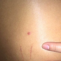 这像是自己能够爪到的吗？还是被人抓的