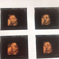 跟四维单像吗😁😁