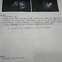 按照最后经期推算现应17周 ,今天去检查才得16周 ，小了一周，体重也才80斤，会对宝宝有影响不？
