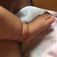 有宝宝出现踝关节不对称情况吗？左关节摸起来骨头不对称，目前宝宝不哭不闹，状态也很好。