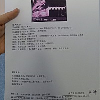 老铁们 这是男还是女？