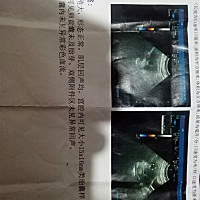 听说BC单能看出男宝或女宝，求有经验的帮忙看下男或女？感谢