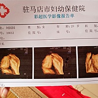 查个四维查两遍，第一次一直趴那，然后走了二十分钟才扭过来脸，还算清晰😂