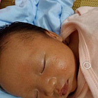 亲们这些是胎毒造成的吗？怎么办