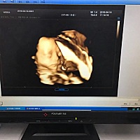 我儿子14天了……