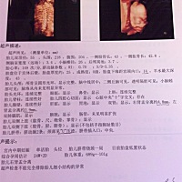 今天刚做的四维彩超，有会看男孩女孩的宝妈吗？帮我看看