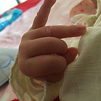 39周3开始感觉肚子疼去的医院，结果在医院呆了4天又没动静就回家了，到40周5还是没动静就去的医院，医院...